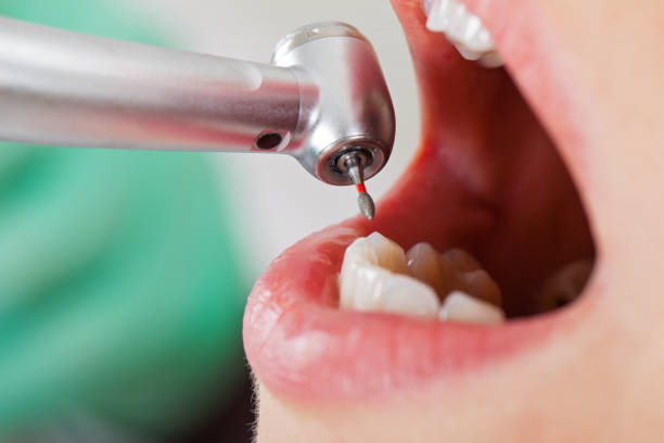 Best Orthodontic Emergency Dentist in James City, NC